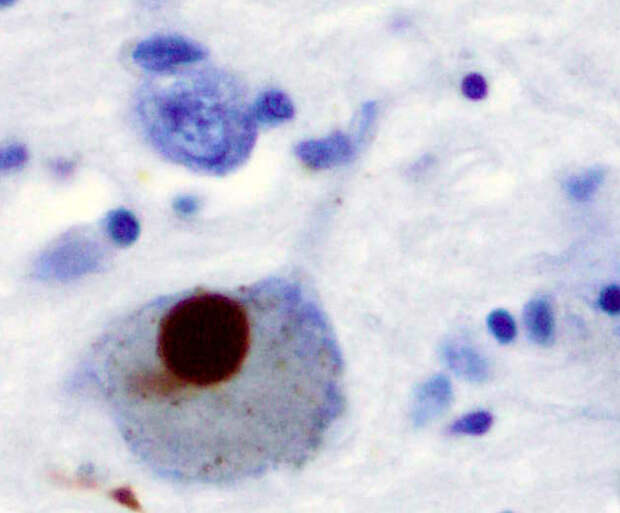 Рис. 3. Черное пятно — тельце Леви в нейроне
