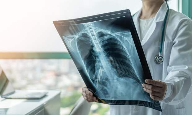 «Последствия увидим через 20 лет»: онколог Евсеев объяснил, почему вейп не лучше сигарет