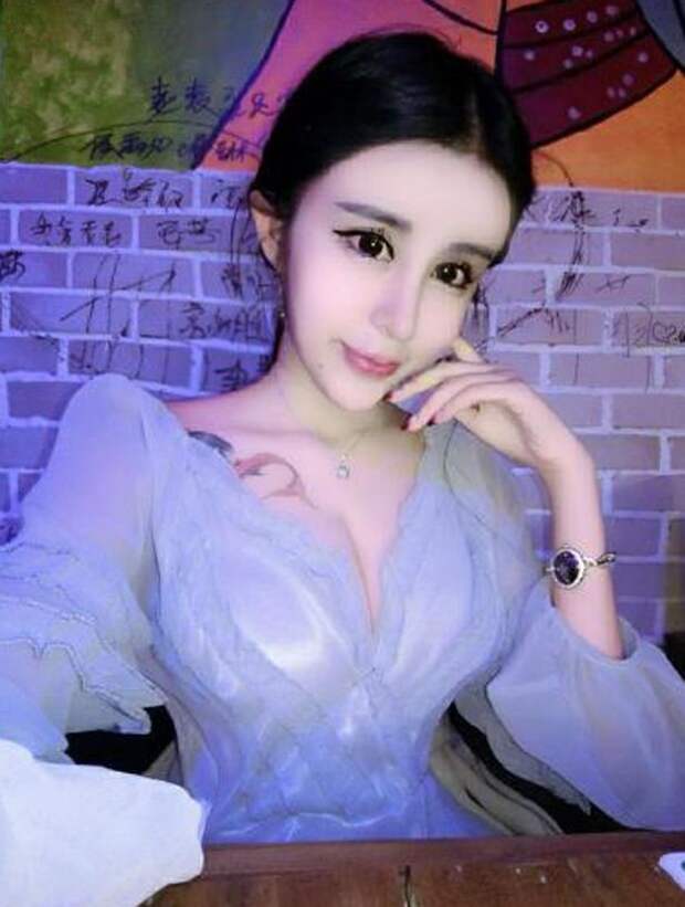 15-летняя китаянка пережила массу пластических операций, чтобы вернуть бойфренда внешность, операция