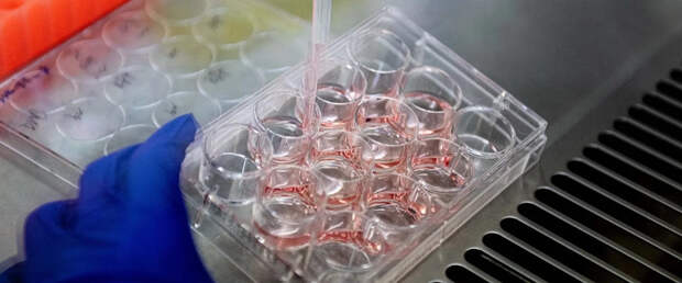 В структуре нервной клетки нашли встроенный механизм защиты от болезни Альцгеймера