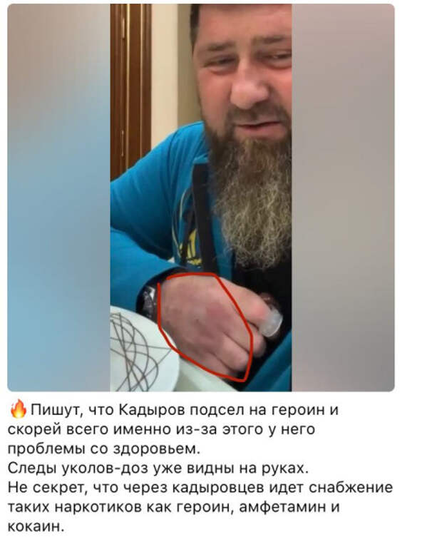 Кадыров умирает. Рамзан Кадыров при смерти. Кадыров и Делимханов. Чеченский депутат