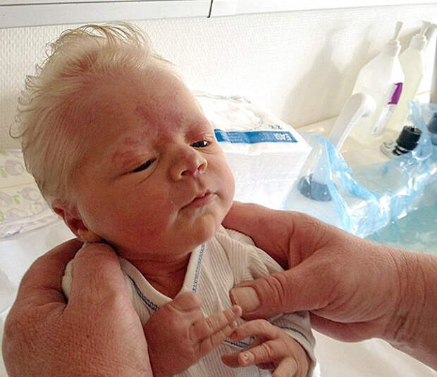 Так выглядят новорожденные норвежцы волосатые, младенцы, смешные дети