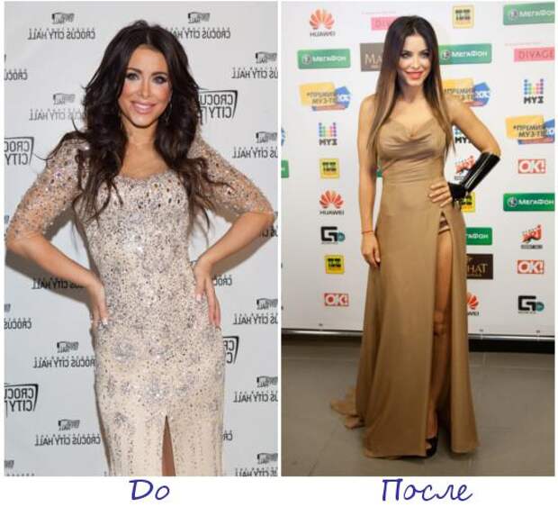 Ани Лорак фото до и после похудения