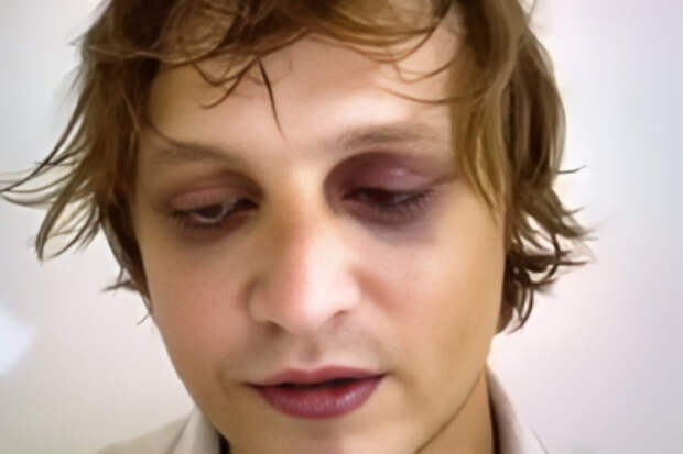 Похищенный на Бали украинский мошенник рассказал о работе колл-центров. Сдал «крышу» и подельников