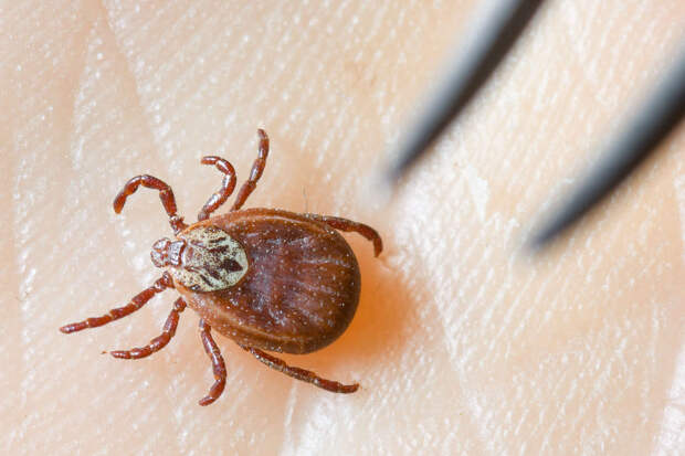 Педиатр Веселов: клеща у ребенка нужно удалять сразу, не боясь оставить голову