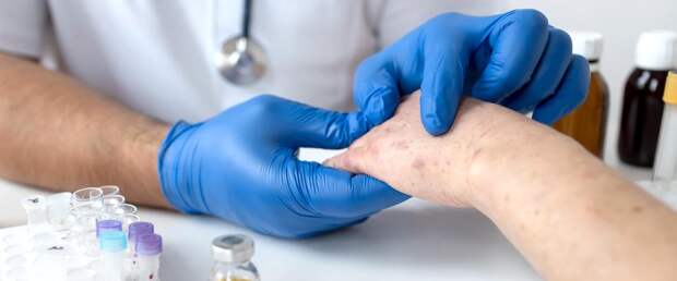 Светотерапия лечит псориаз без побочных эффектов