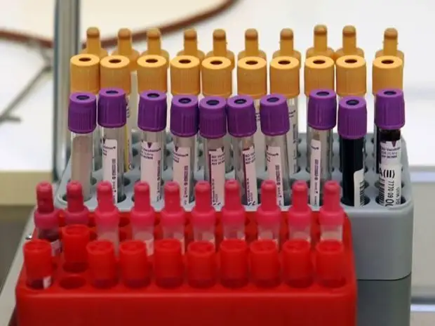 Хирург Шпилевой рассказал о «золотой» группе крови