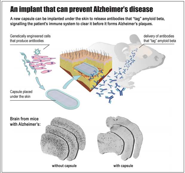 Image credit: EPFL