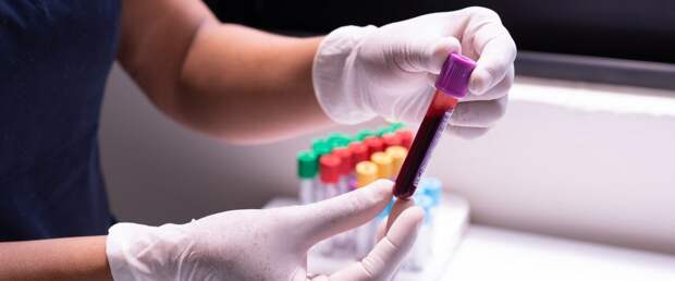 По метаболитам крови можно оценить риски диабета за годы до симптомов