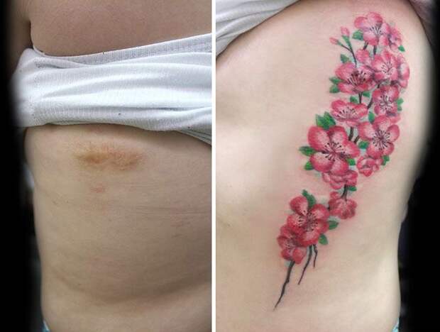 Татуировщица бесплатно перекрывает шрамы женщинам, Флавия Карвальo, Flavia Carvalho