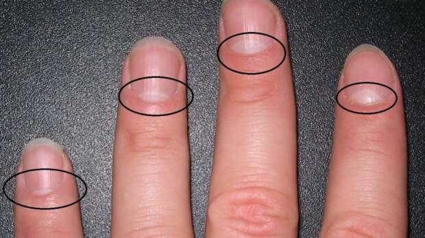 Вы знаете, что на самом деле означает форма полумесяца на ваших ногтях? Ответ более важен, чем вы думаете