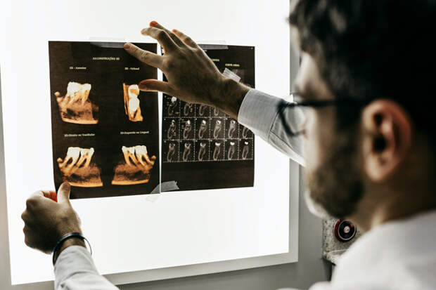 Выращивание и 3D-печать зубов: 6 прорывных технологий в стоматологии