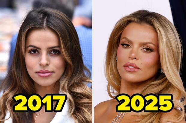 Brooks Nader Addressed Being "Addicted To GLP-1" And All The Cosmetic Work She's Had Done