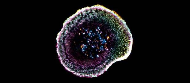 Как цитотоксические Т‑лимфоциты уничтожают раковые клетки