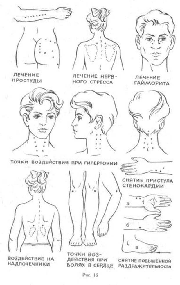 НАЖИМАЯ НА ТОЧКИ ВАШЕГО ТЕЛА ИЗБАВЛЯЕМСЯ ОТ БОЛИ