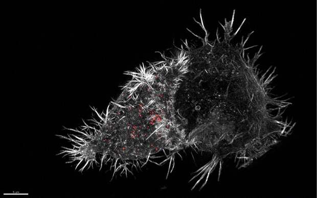 3D-микроскопическое изображение внутренней борьбы: иммунная NK-клетка (естественный киллер) атакует инфицированную клетку, свою цель.