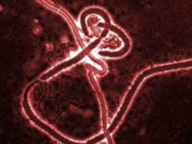 На следующей неделе начинаются испытания вакцины против лихорадки Эбола На следующей неделе начинаются испытания вакцины против лихорадки Эбола