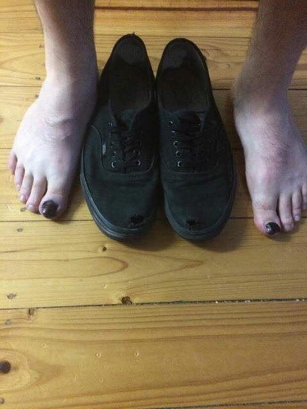 Обувь не по размеру