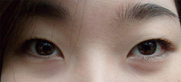 Почему у азиатов узкие глаза
