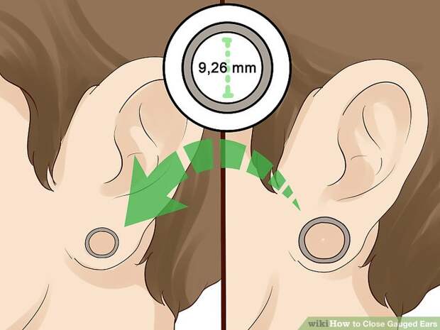 Image titled Close Gauged Ears Step 2.jpeg