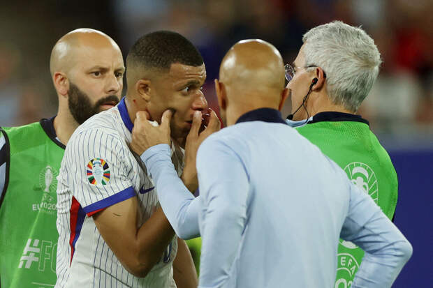 Форвард сборной Франции вернулся в расположение команды после перелома носа