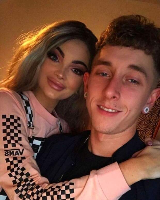 22-летняя визажист сделала себе рыбьи губы за 00 и стала объектом насмешек
