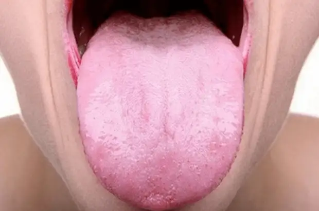 Что расскажет язык о вашем здоровье