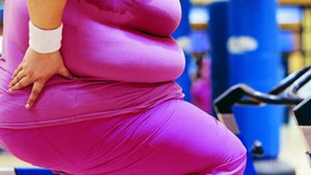 Obesity-Photo-for-Source