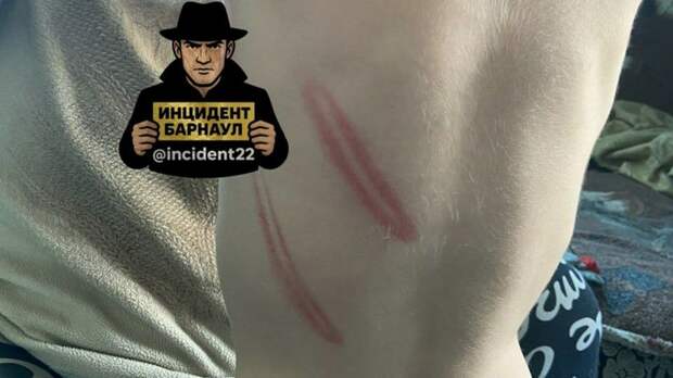 Мать избила ребенка / Фото: 