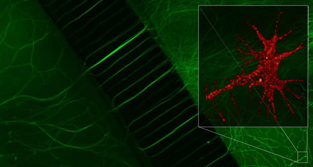 A nerve cell protein (inset, glowing red) resides throughout the splayed tip of a mouse nerve and ferries the rabies virus (green dots in inset) up cells’ long extensions (green diagonal lines).
