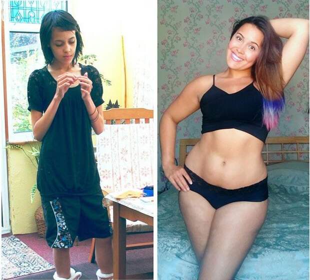 Девушка едва не умершая от анорексии набрала вес и публикует свои фото в бикини, чтобы помочь другим бывшая анорексичка размещает фото в бикини, бодипозитив, Меган Джейн, Megan Jayne