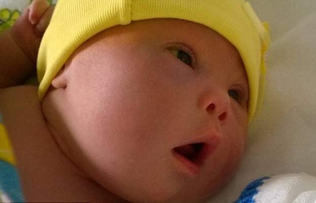 Между женой и сыном с синдромом Дауна мужчина выбрал ребенка жена, заболевание, муж, ребенок, семья, синдром дауна
