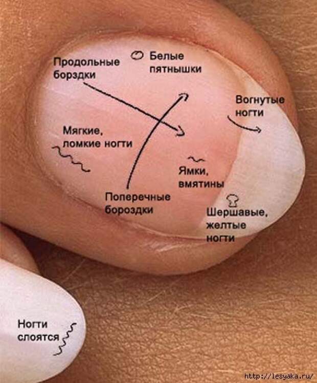 ЧТО ГОВОРЯТ НОГТИ О НАШЕМ ЗДОРОВЬЕ ЧТО ГОВОРЯТ НОГТИ О НАШЕМ ЗДОРОВЬЕ