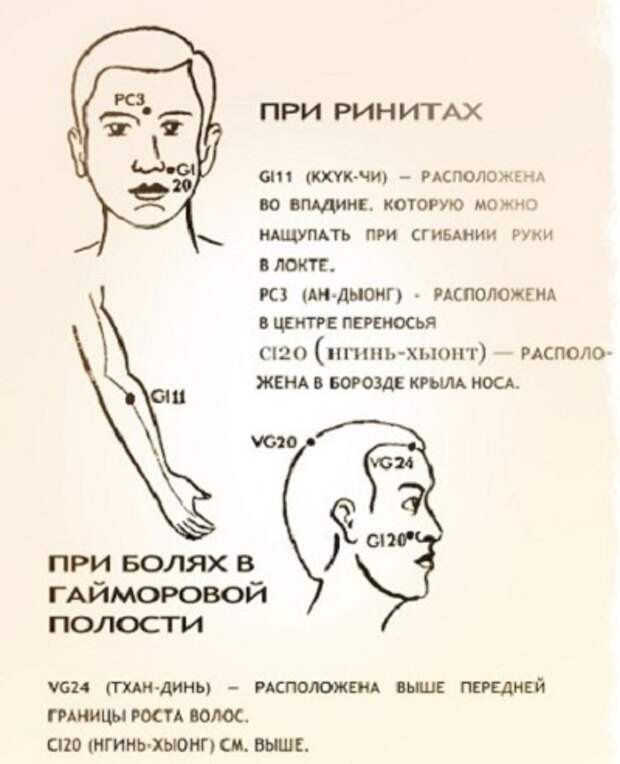 насморк