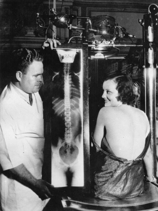 Кинозвезда Джудит Аллен со снимком своей спины, 1930 первые, ренген, фото
