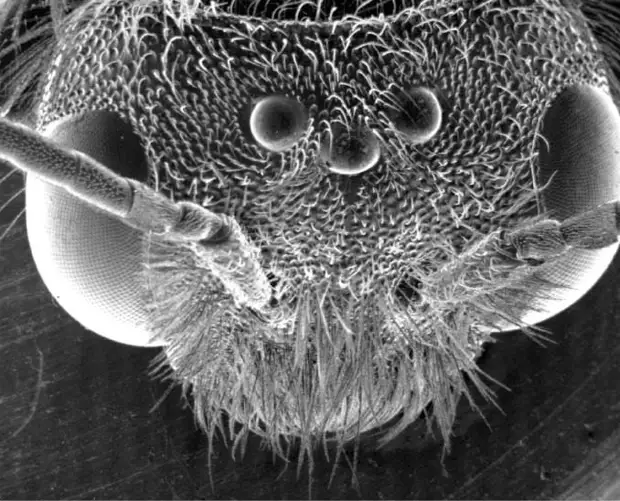 Фото микробов под ногтями для детей