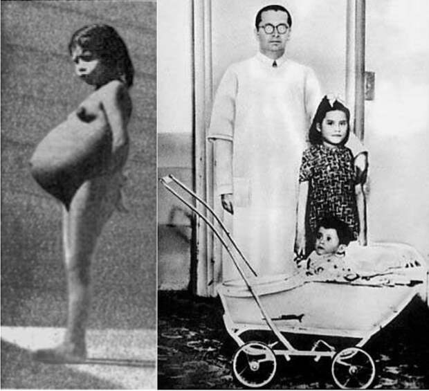 Слева – Лина Медина, апрель 1939, срок беременности – 7,5 месяцев. Справа – доктор Херардо Лосада, Лина Медина и ее 11-месячный сын Слева – Лина Медина, апрель 1939, срок беременности – 7,5 месяцев. Справа – доктор Херардо Лосада, Лина Медина и ее 11-месячный сын
