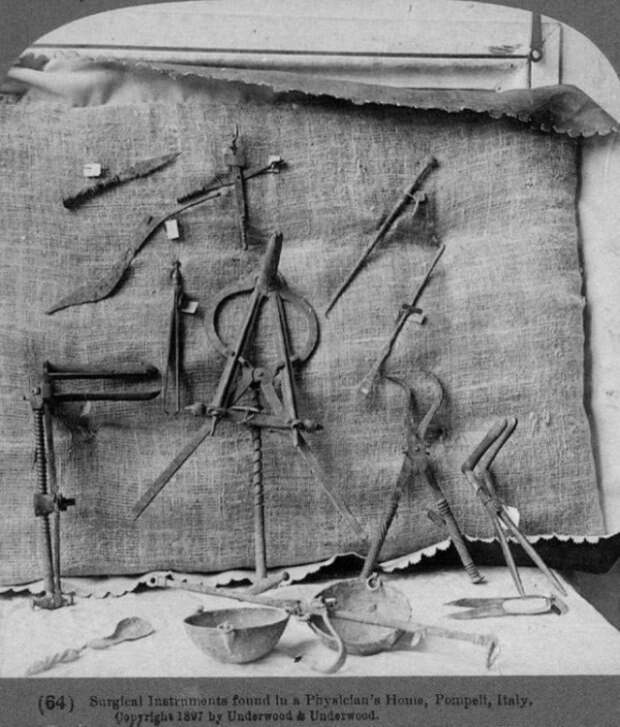 Римские хирургические инструменты, найденные в доме врача в Помпеях, Италия, I век СССР, история, факты, фото.