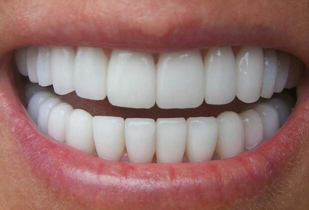 Заболели зубы10 народных советов помогут вам