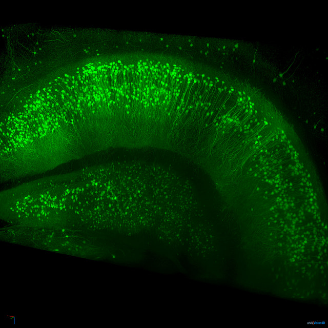 Нейроны мышиного гиппокампа. (Фото ZEISS Microscopy / Flickr.com.)
