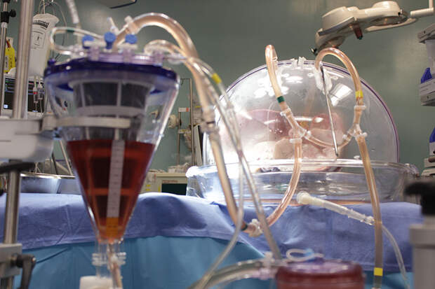 Ученые из Канады нашли способ изменения группы крови в органах для трансплантации