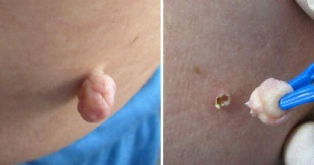 5-15073981388k4ng-520x273