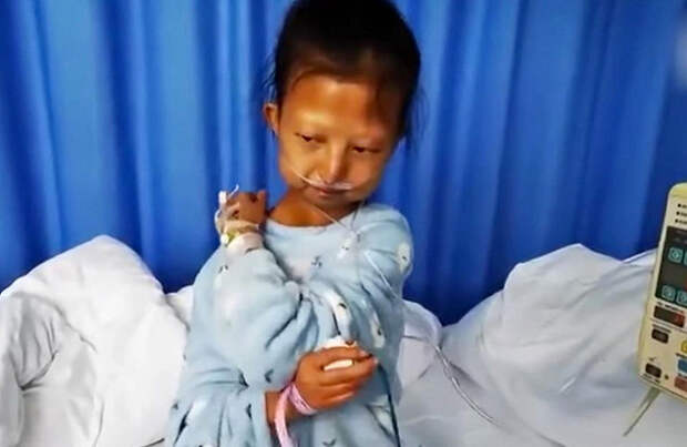 Китаянка питалась одним рисом и умерла