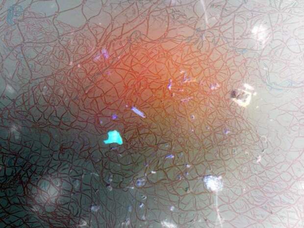 Микропластик внутри и вокруг нас: как крохотные частицы стали проблемой человечества