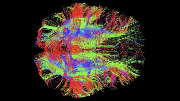 Нервные волокна в мозгу человека