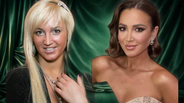 Звездные метаморфозы: кто расцвел с годами, а кого не пощадило время