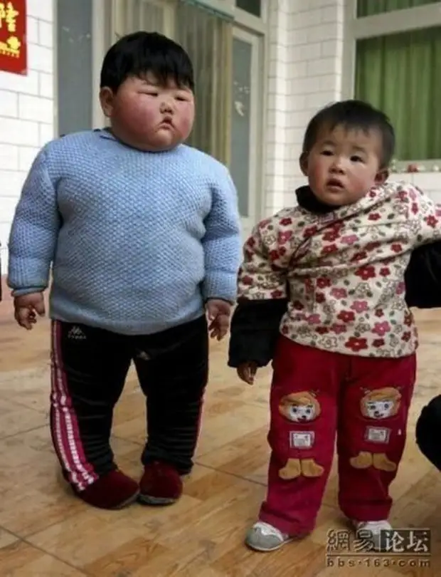 Русско китайский мальчик. Самый жирный ребенок в мире.