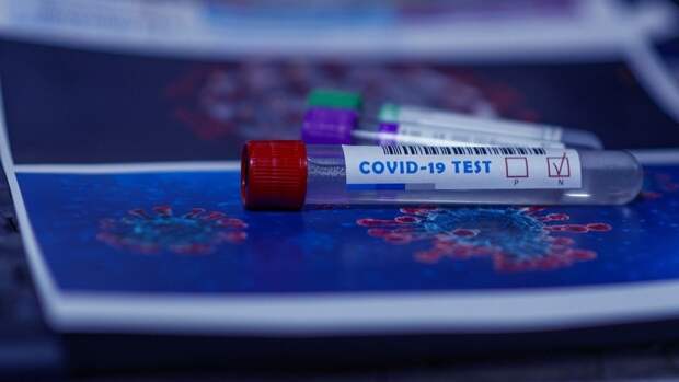 Российский врач объяснил принцип действия экспресс-теста на антитела к COVID-19