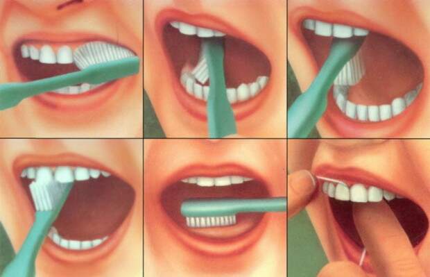 Что будет, если не чистить зубы? интересное, медицина