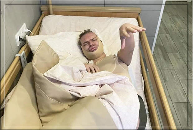 Гоген Солнцев перенёс не одну пластическую операцию.